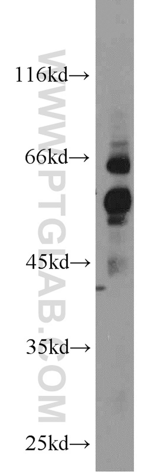 GPR177 Antibody in Western Blot (WB)