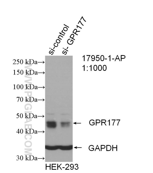 GPR177 Antibody in Western Blot (WB)