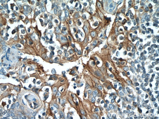 PD-L1/CD274 Antibody in Immunohistochemistry (Paraffin) (IHC (P))