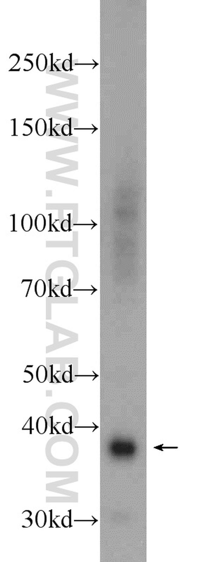 SRR Antibody in Western Blot (WB)