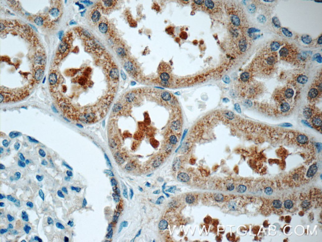 SRR Antibody in Immunohistochemistry (Paraffin) (IHC (P))