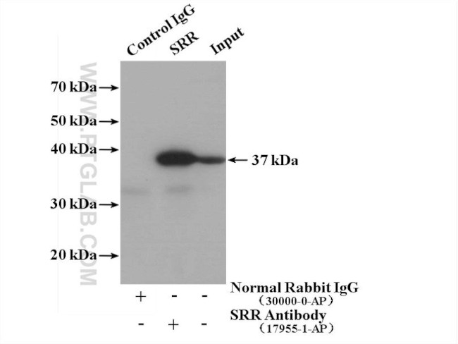 SRR Antibody in Immunoprecipitation (IP)