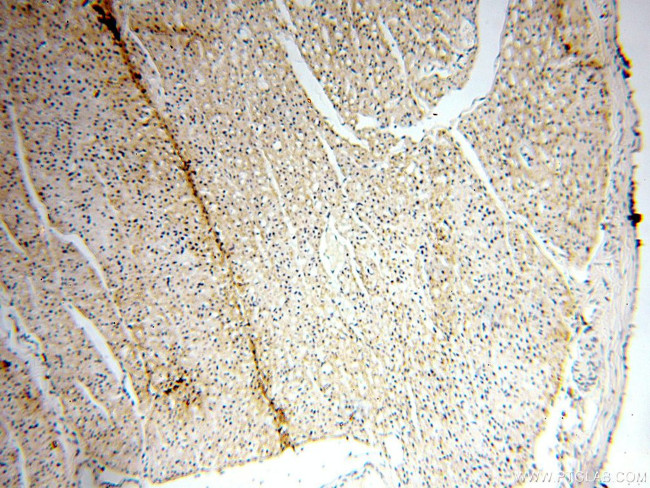 LOX Antibody in Immunohistochemistry (Paraffin) (IHC (P))