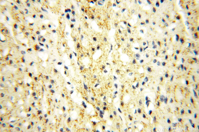 LOX Antibody in Immunohistochemistry (Paraffin) (IHC (P))