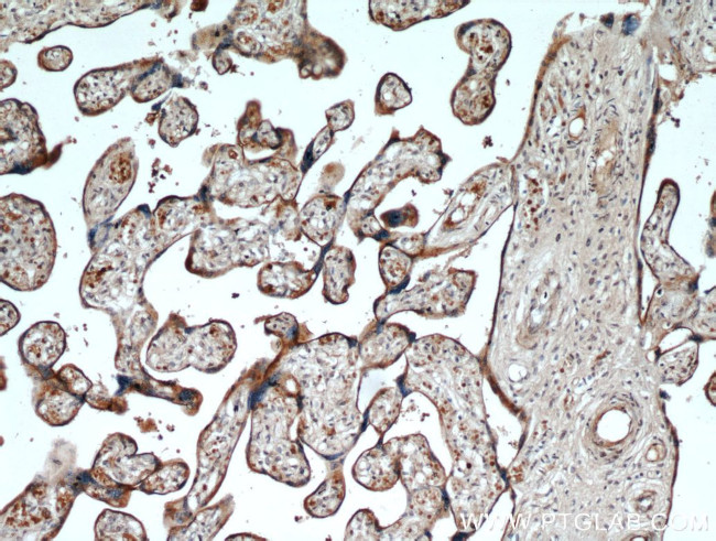 LOX Antibody in Immunohistochemistry (Paraffin) (IHC (P))