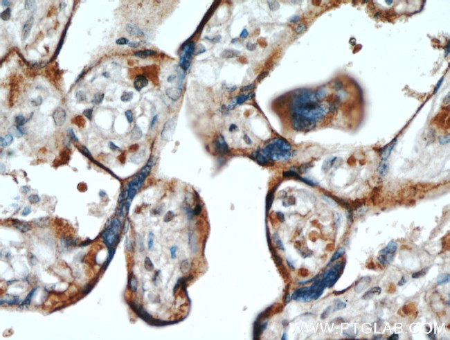 LOX Antibody in Immunohistochemistry (Paraffin) (IHC (P))