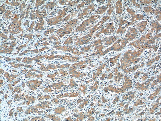 LOX Antibody in Immunohistochemistry (Paraffin) (IHC (P))