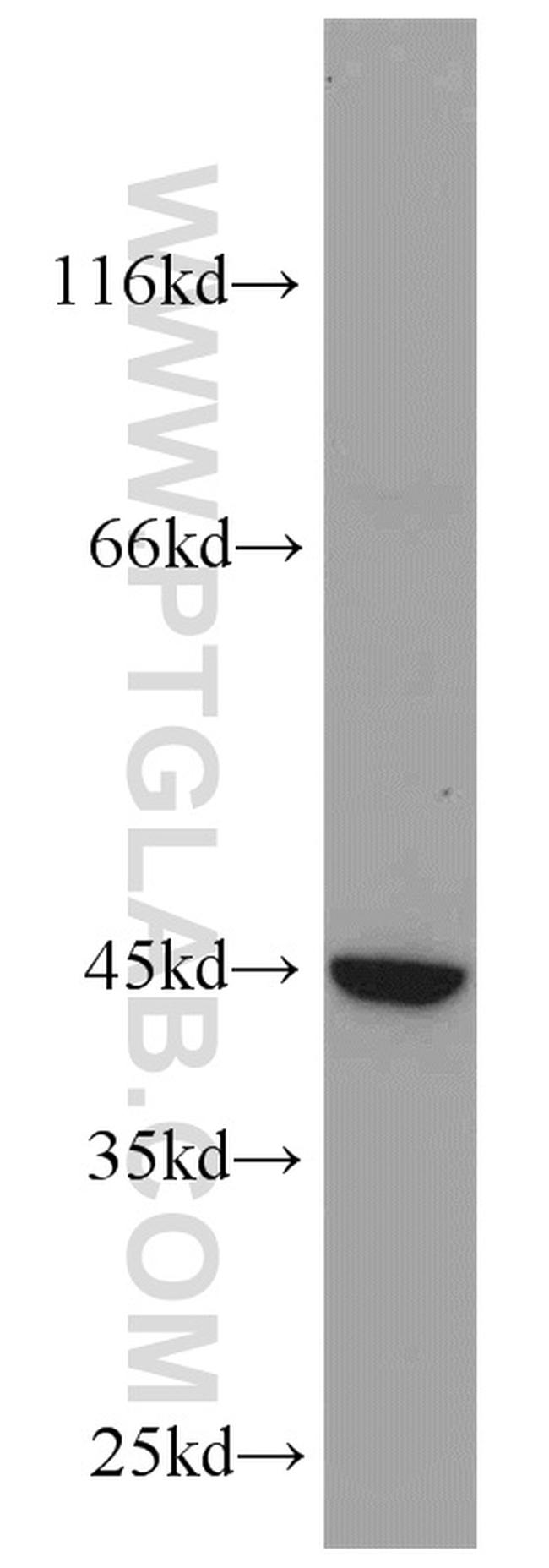 LOX Antibody in Western Blot (WB)