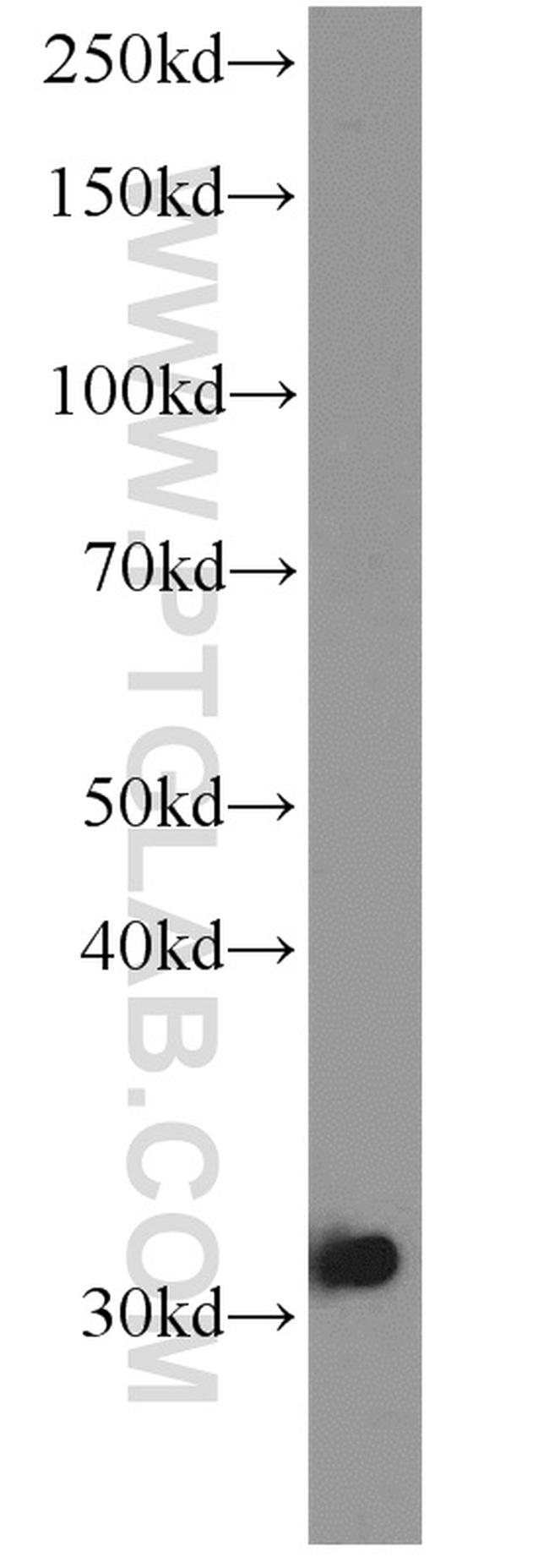 LOX Antibody in Western Blot (WB)