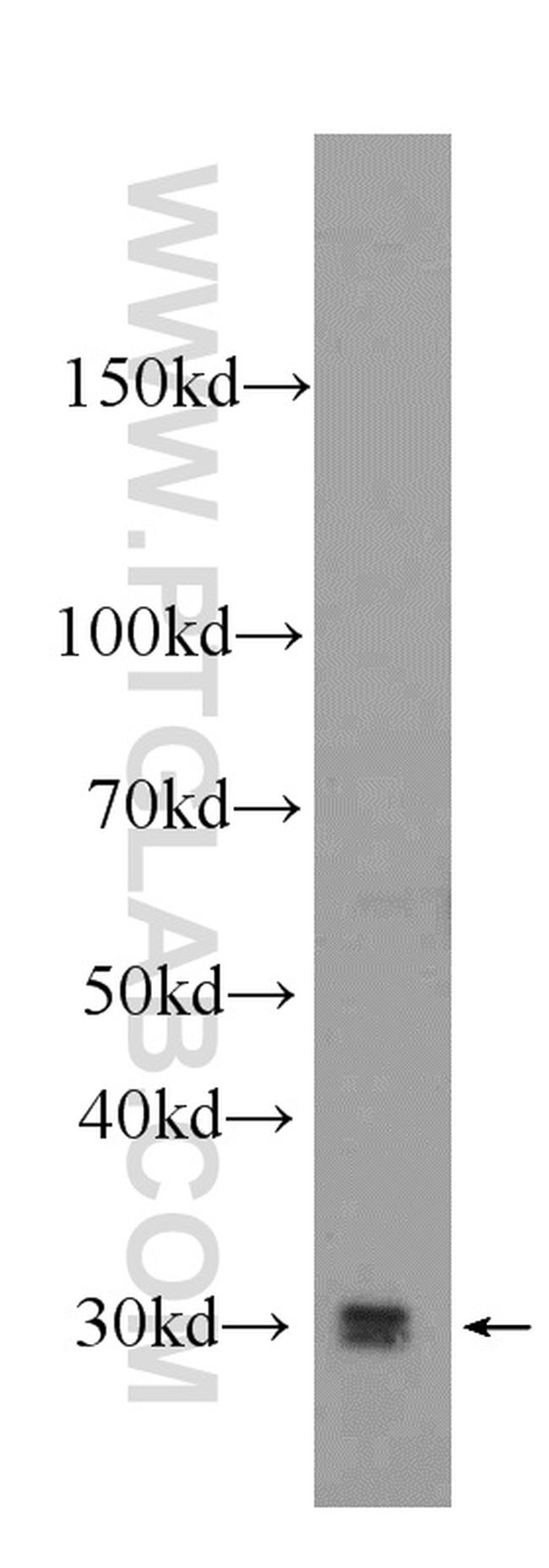 LOX Antibody in Western Blot (WB)