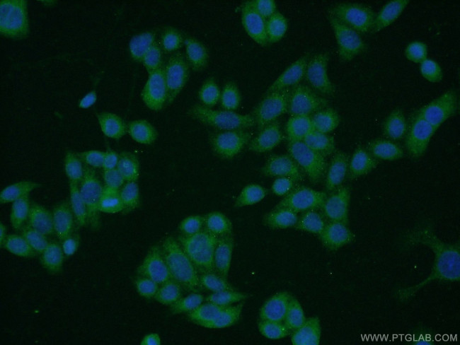 uPA Antibody in Immunocytochemistry (ICC/IF)