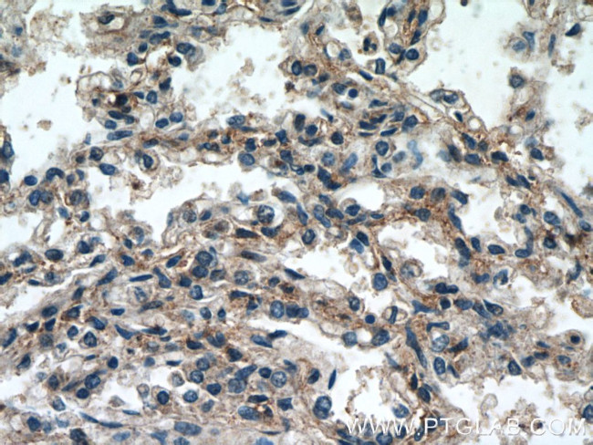 RASIP1 Antibody in Immunohistochemistry (Paraffin) (IHC (P))