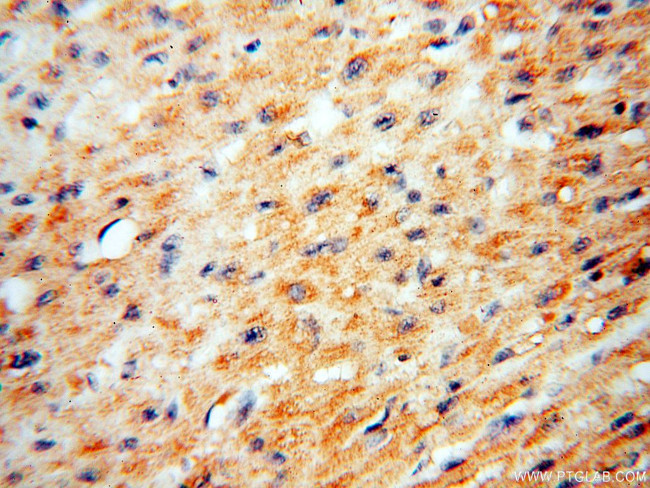 BPHL Antibody in Immunohistochemistry (Paraffin) (IHC (P))