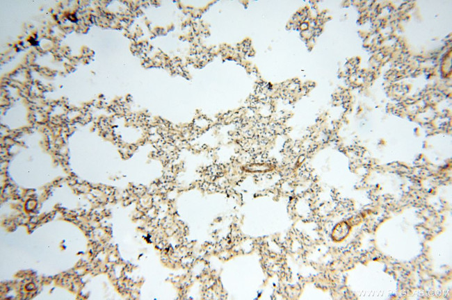 BPHL Antibody in Immunohistochemistry (Paraffin) (IHC (P))