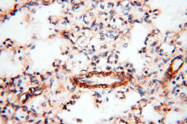 BPHL Antibody in Immunohistochemistry (Paraffin) (IHC (P))