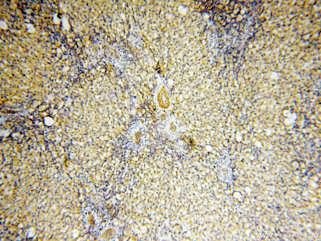 BPHL Antibody in Immunohistochemistry (Paraffin) (IHC (P))