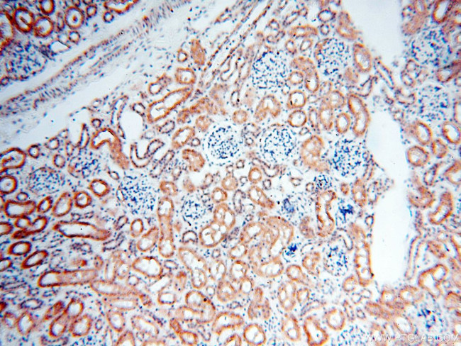 BPHL Antibody in Immunohistochemistry (Paraffin) (IHC (P))