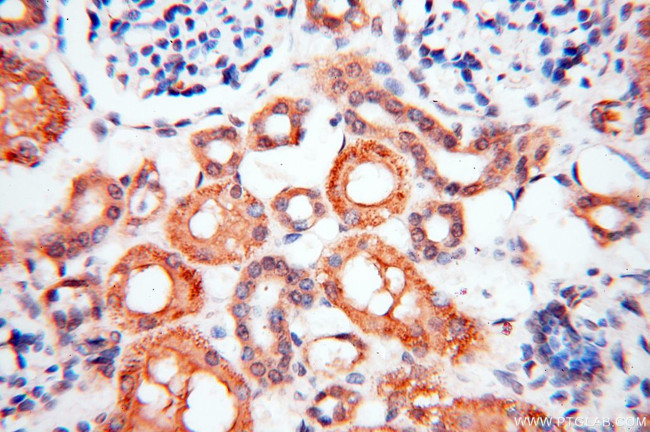 BPHL Antibody in Immunohistochemistry (Paraffin) (IHC (P))