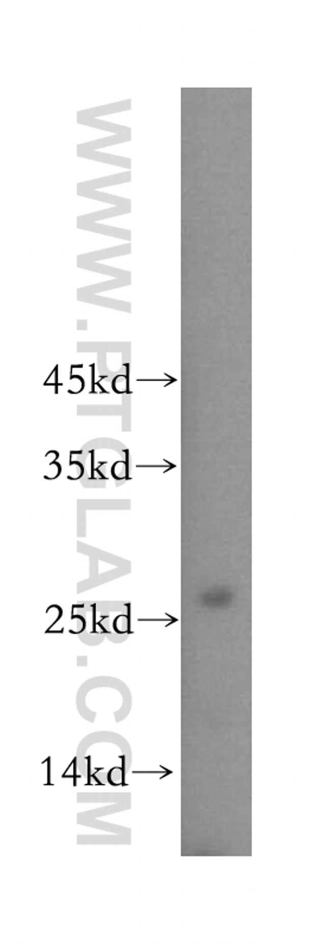 BPHL Antibody in Western Blot (WB)