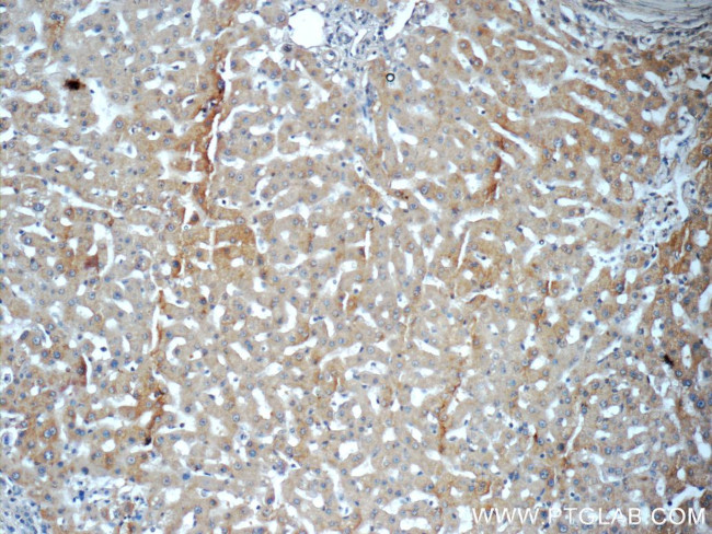 Acetylcholinesterase Antibody in Immunohistochemistry (Paraffin) (IHC (P))