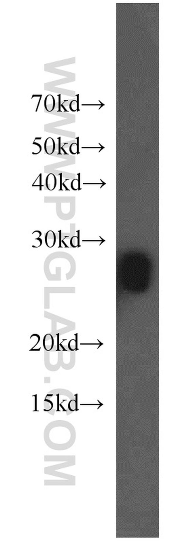 MIP Antibody in Western Blot (WB)