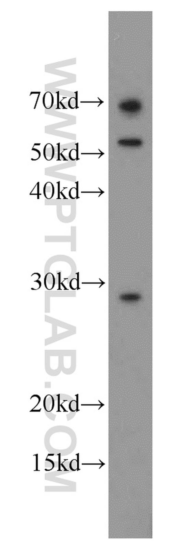 MIP Antibody in Western Blot (WB)