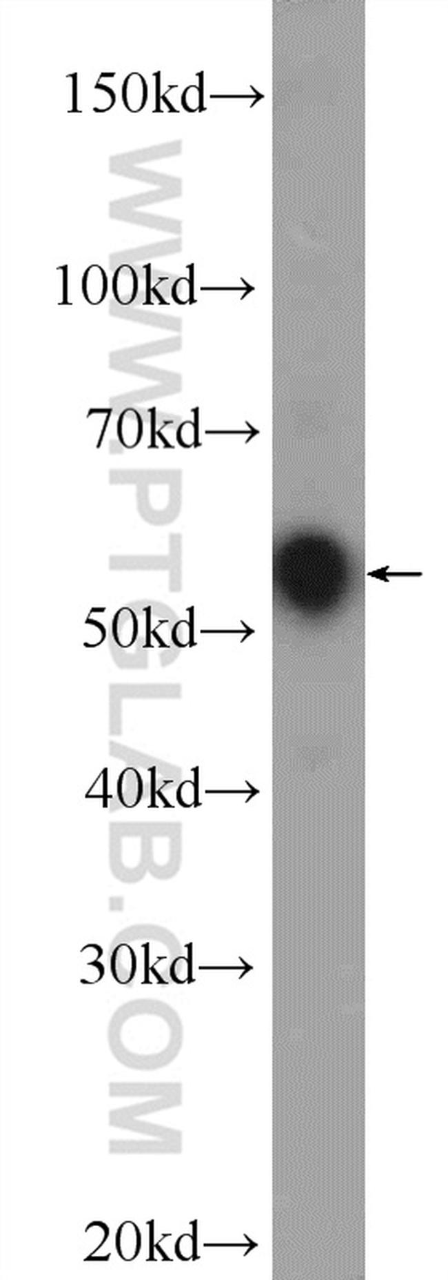 Cannabinoid receptor 1 Antibody in Western Blot (WB)