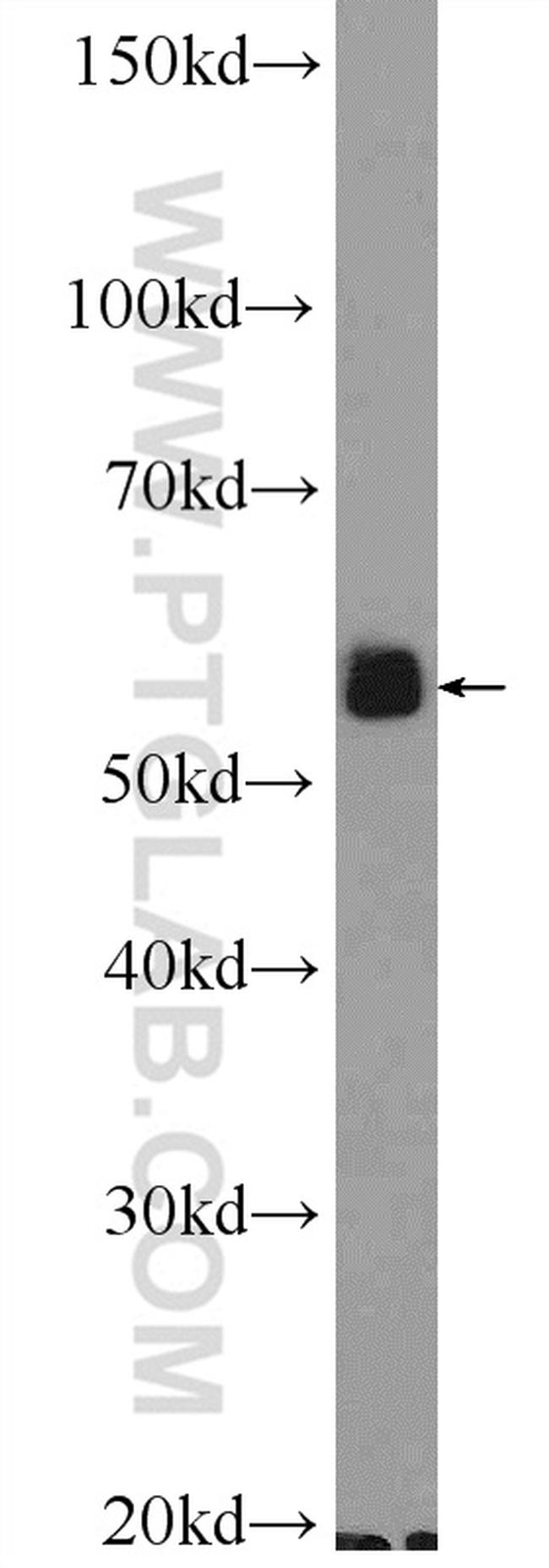 Cannabinoid receptor 1 Antibody in Western Blot (WB)