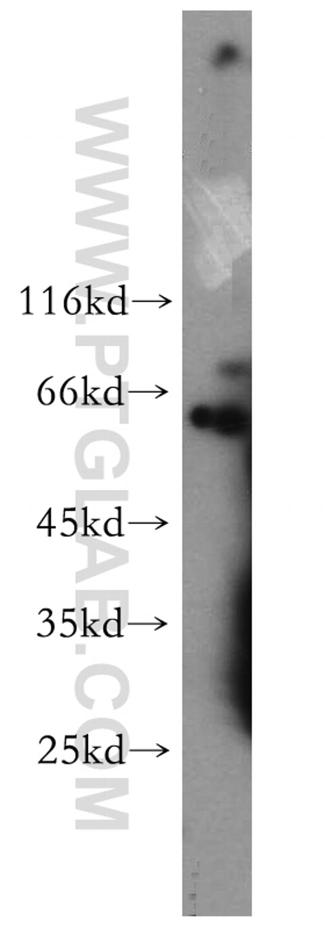 Cdc7 Kinase Antibody in Western Blot (WB)