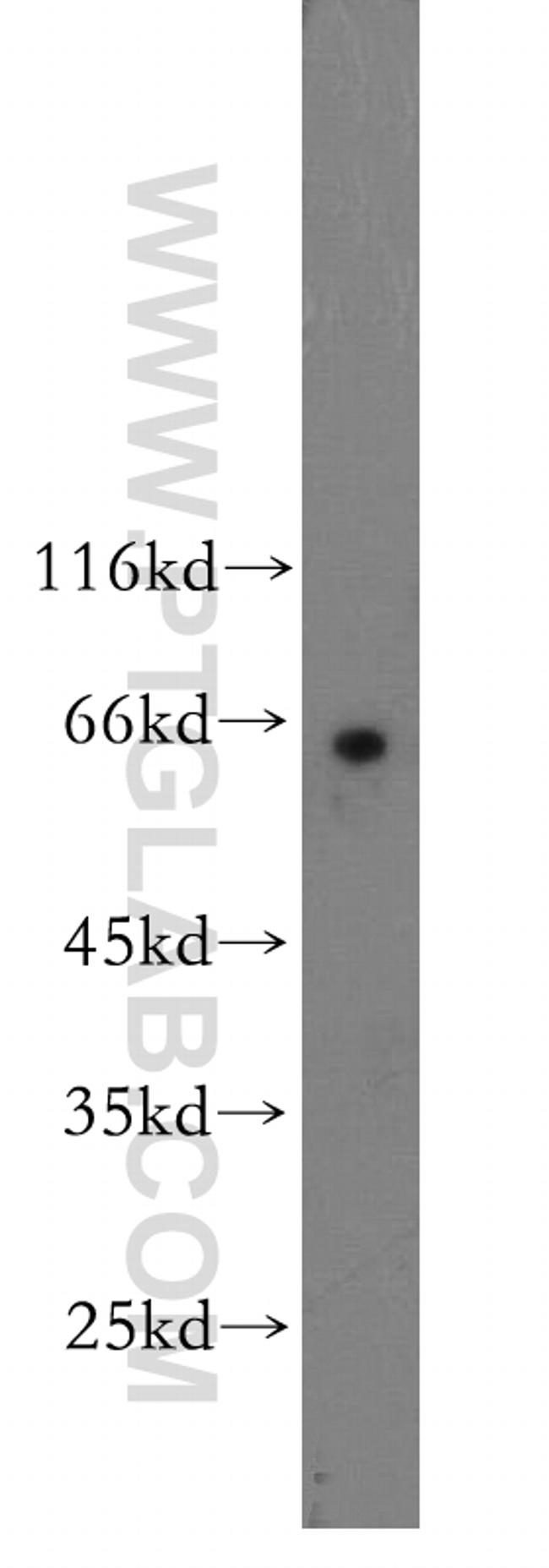 Cdc7 Kinase Antibody in Western Blot (WB)