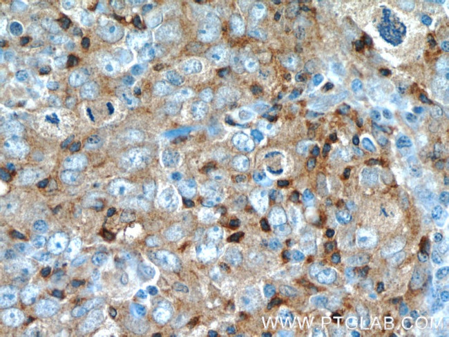 UGT8 Antibody in Immunohistochemistry (Paraffin) (IHC (P))