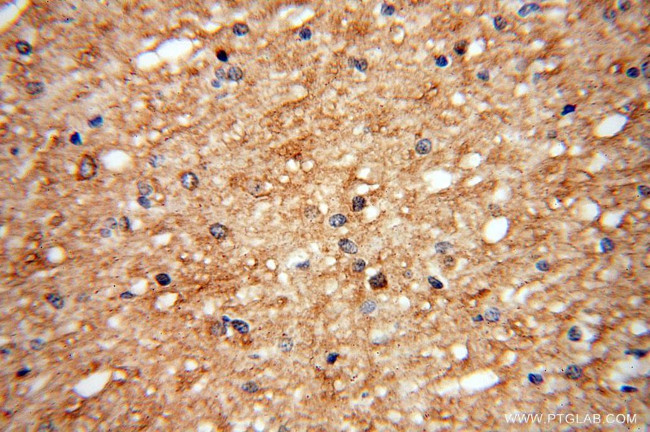 UGT8 Antibody in Immunohistochemistry (Paraffin) (IHC (P))