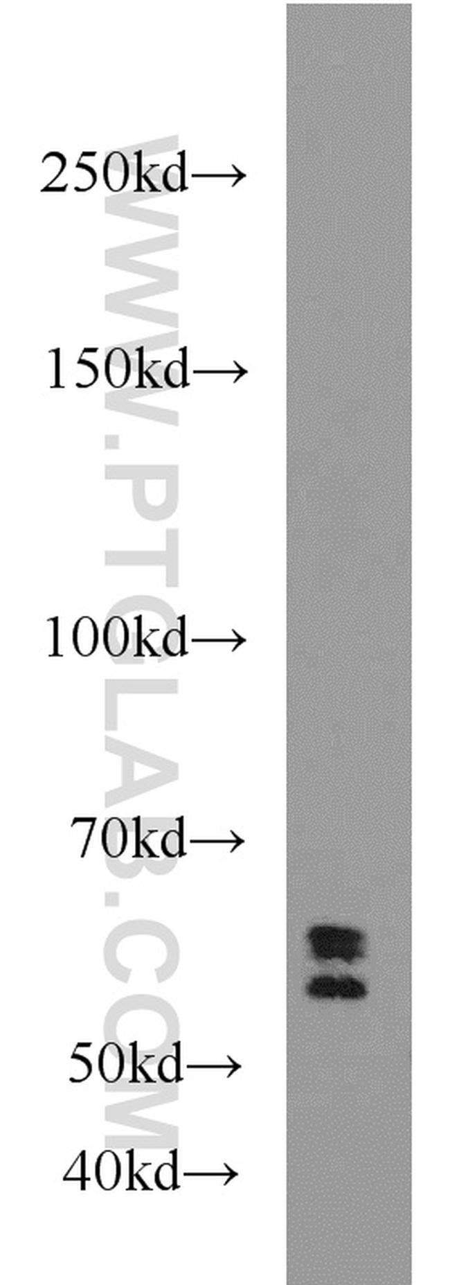 UGT8 Antibody in Western Blot (WB)