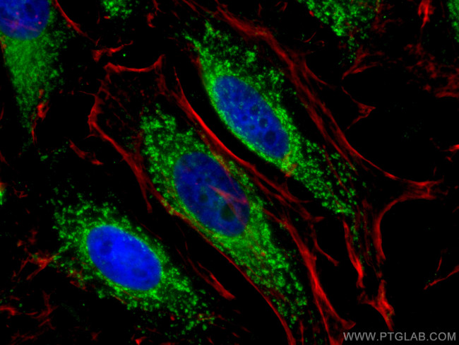 AIF Antibody in Immunocytochemistry (ICC/IF)