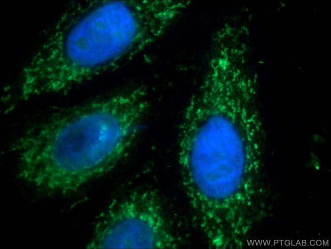 AIF Antibody in Immunocytochemistry (ICC/IF)