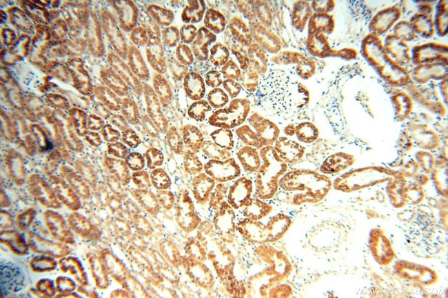 AIF Antibody in Immunohistochemistry (Paraffin) (IHC (P))