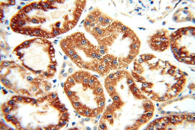 AIF Antibody in Immunohistochemistry (Paraffin) (IHC (P))