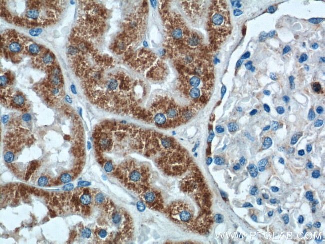 AIF Antibody in Immunohistochemistry (Paraffin) (IHC (P))