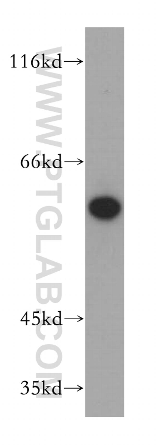 AIF Antibody in Western Blot (WB)