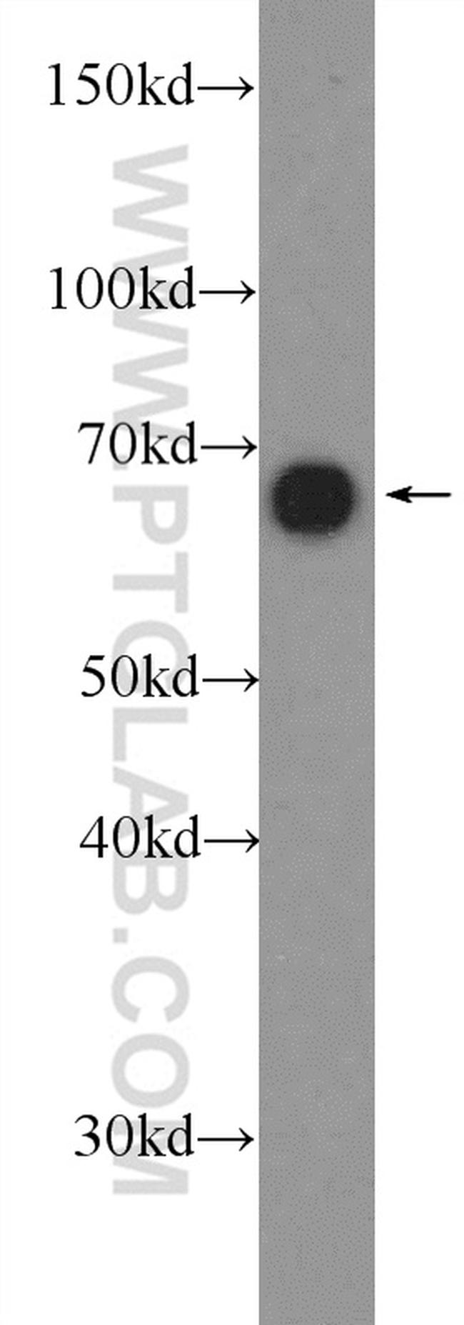 AIF Antibody in Western Blot (WB)