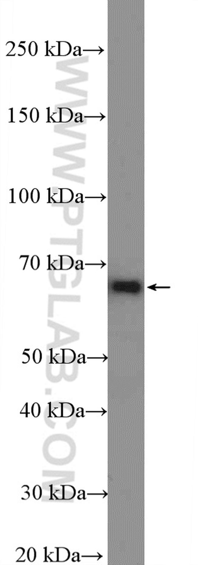 AIF Antibody in Western Blot (WB)