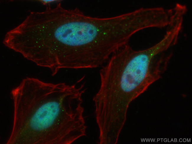 ADNP Antibody in Immunocytochemistry (ICC/IF)