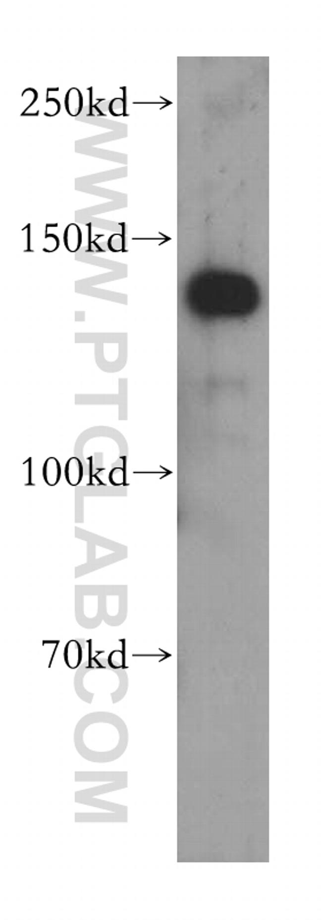 ADNP Antibody in Western Blot (WB)