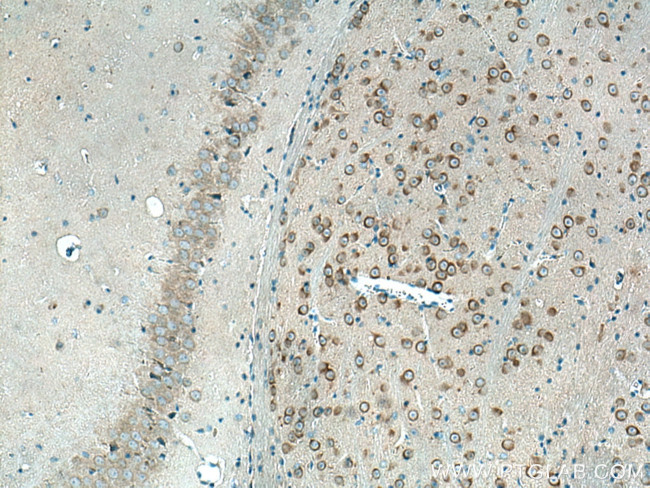 REEP1 Antibody in Immunohistochemistry (Paraffin) (IHC (P))