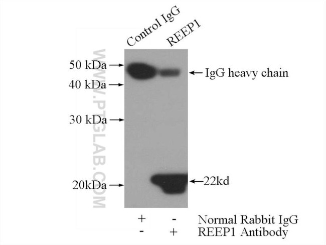 REEP1 Antibody in Immunoprecipitation (IP)