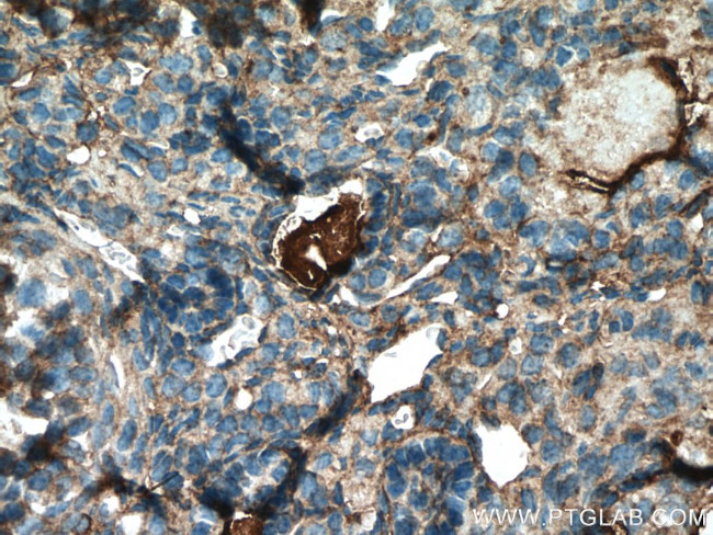 AANAT Antibody in Immunohistochemistry (Paraffin) (IHC (P))