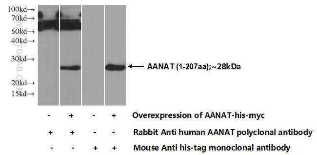 AANAT Antibody in Western Blot (WB)