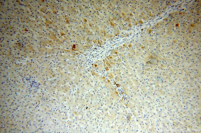 APOA4 Antibody in Immunohistochemistry (Paraffin) (IHC (P))