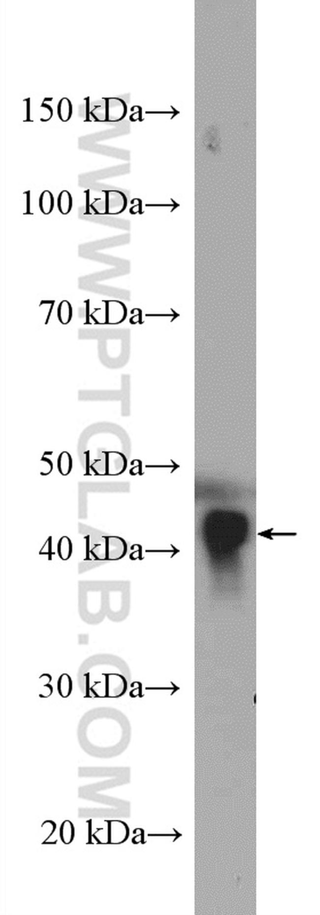 APOA4 Antibody in Western Blot (WB)