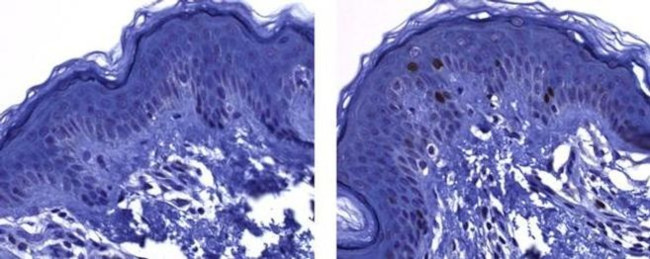 Mouse IgG1 Secondary Antibody in Immunohistochemistry (Paraffin) (IHC (P))